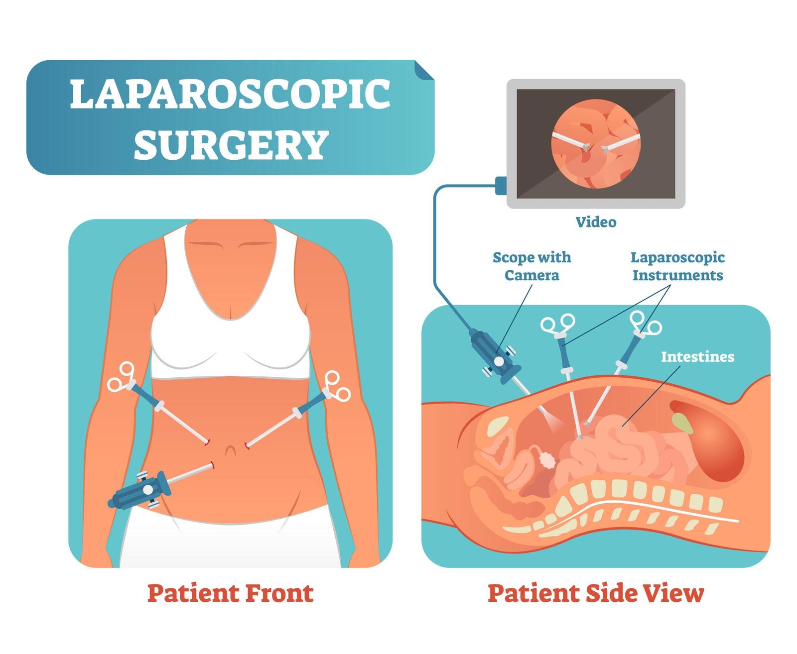 Laparoscopic Services